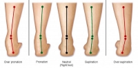 Effect of footwear modification on postural symmetry and body balance in leg length Discrepancy: A randomized controlled study